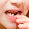 Chiêm bao thấy sâu răng là điềm báo gì? Đánh con nào?